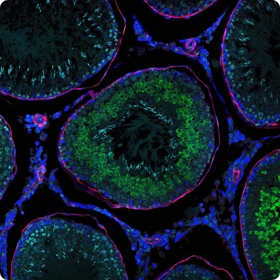 Red Smooth Muscle Actin Protein