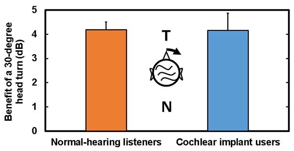 cochlear implant graph