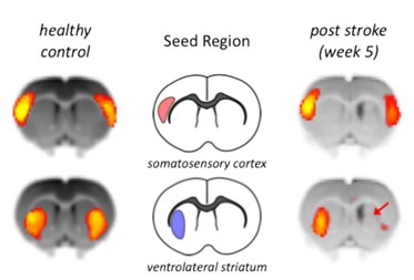 Loss of Functional Connectivity after Stroke.