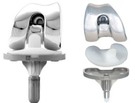 EUROP POSTERO Prosthesis from Euros