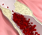 Treatments for Atherosclerosis
