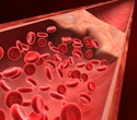 Extended use of anti-clotting drugs reduces risk of recurrent blood clots