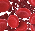 Hemoglobin emerges as a natural antioxidant defense in the brain