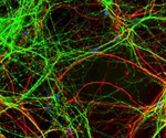 Halting neurogenesis improves working memory in mice