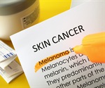 Examining skin cancer risk perceptions and reported sunburns among U.S. adults