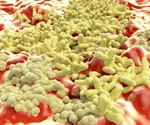 Some antibiotics may make MRSA more harmful