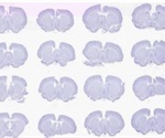 TissueScope™ - Huron Digital Pathology’s Rodent Brain Imaging Solution