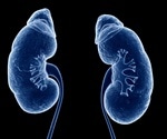 Researchers find link that could aid in treatment of kidney cyst diseases
