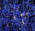 FAU researchers create deep learning model that detects and evaluates Alzheimer's, FTD