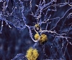 Health authorities reviewing scientific data from trials evaluating Alzheimer's treatment, Reminyl