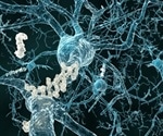 New European initiative aims to transform real world Alzheimer’s disease care