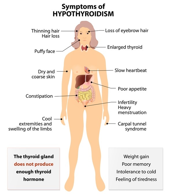 Signs and Symptoms thyroid dysfunction Image Copyright: Designua / Shutterstock