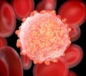New medication offers potential treatment for patients with deadliest form of blood cancer