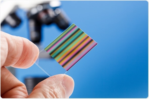 Chromatography genetic fingerprinting - Image Copyright: science photo / Shutterstock