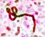Research describes blood disorders and their impact on Ebola patient outcomes