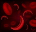 Challenges and opportunities in delivering gene therapies for sickle cell disease and beta thalassemia