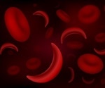Understanding Sickle Cell Disease