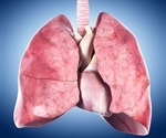 Pandorabactins help pathogenic bacteria compete for iron in the lungs