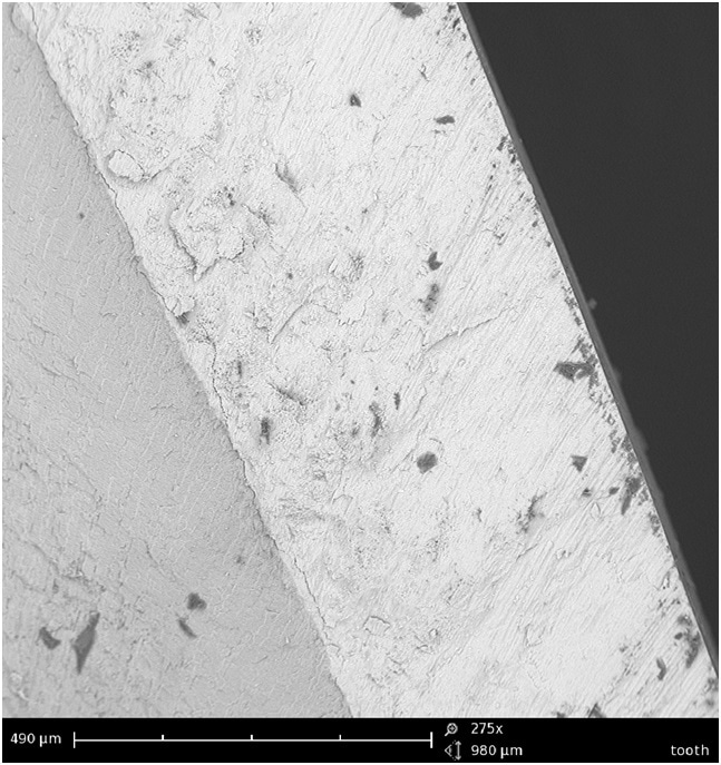 Scanning electron microscopy (SEM)