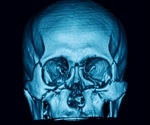Maxillofacial Injuries