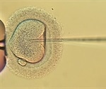 In Vitro Fertilization (IVF)