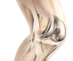 DePuy Synthes knee system shown to be beneficial for economics and patient reported outcomes