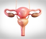 Pelvic Inflammatory Disease Management and Prognosis