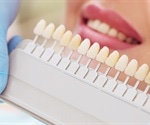 Why your dentist might seem pushy