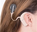 When a hearing aid isn’t enough