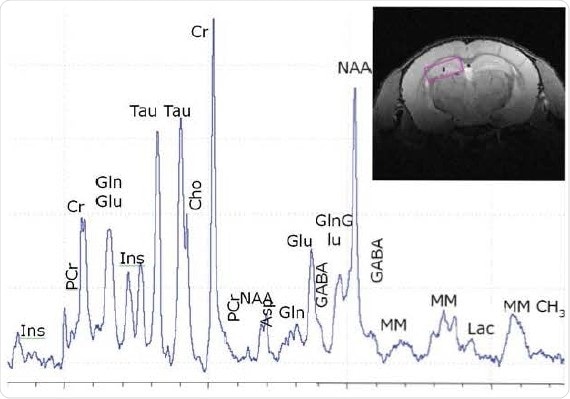 Localized 1H spectroscopy in mouse brain at 11.7 T in a 2.7µl voxel