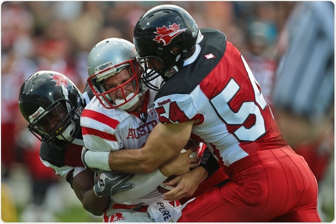 Image Credit: Herbert Kratky - Chronic Traumatic Encephalopathy (CTE) among former American football players: Study