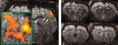 High resolution BOLD activation at 11.7 Tesla using the four-element array coil with a resolution of 75 x 75 x 1000 μm3 for detection of (left) sub-structures within S1, and activation within other regions along the neuronal pathway: S2 and thalamus