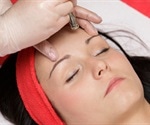 Dermabrasion During Pregnancy