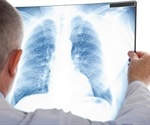 Walking Pneumonia Versus Bronchitis