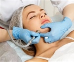 Who Can Perform Dermabrasion?