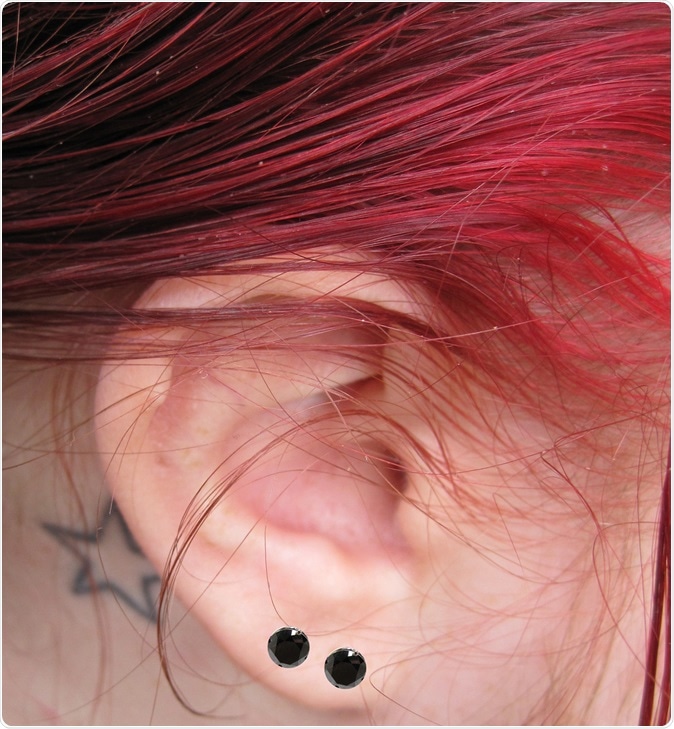 Image Credit: Peter Baxter / Shutterstock