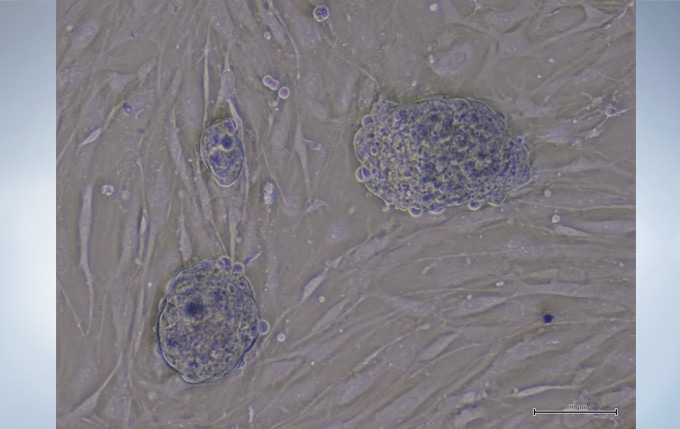 Experience 3D Views Driven by the “Inversion Contrast” (IVC) Technique