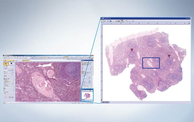 Context Map And High-Magnification Images Stored in a Single File