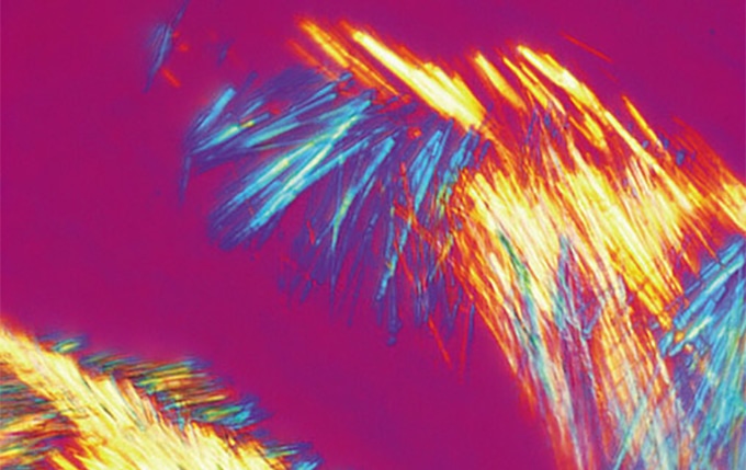 Straightforward Gout Inspection