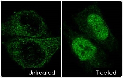 HIF-1a staining of HeLa cells. Anti-HIF-1a antibody [EPR16897] (ab179483) was used at 1/50 dilution with goat anti-rabbit IgG (Alexa Fluor® 488) secondary antibody. Cells were treated with 0.6 nM CoCl2 for 6 hours.