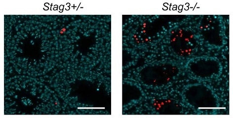 Hopkins J et al used BrdU-Red TUNEL Assay Kit ab66110 to examine apoptosis in testis from 8-week old Stag3+/− and Stag3−/− mice. Apoptotic cells are red. DAPI was used as a counterstain.