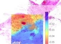 Histology and Terahertz Image Overlay