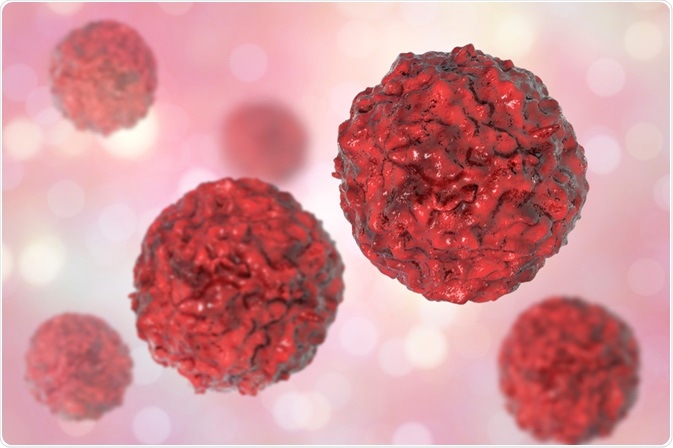 Cancer cells - Kateryna Kon Cancer cells - Kateryna Kon