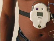 A CPOD strapped onto a person.