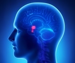 Risk Factors for Pituitary Tumors