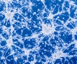 Immunoenzymatic Chromogen Staining