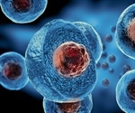 Stem Cell Therapy for Alzheimer's