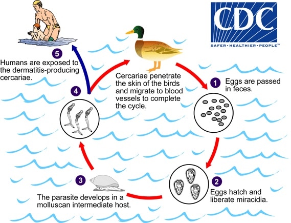 Cercarial dermatitis life cycle Cercarial dermatitis life cycle