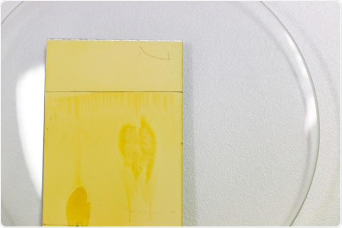 Thin layer chromatography. Image Credit: Rattiya Thongdumhyu / Shutterstock