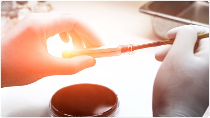 Image Credit: Sirirat / Shutterstock